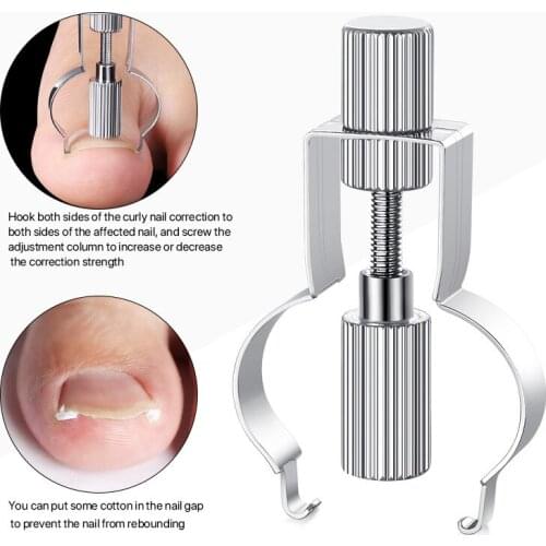 Ingrown Toenail Corrector Ingrown Toenail Lifter Ingrown Toenail Tool Toe Clamp Stainless Steel Foot Care Tool for Paronychia