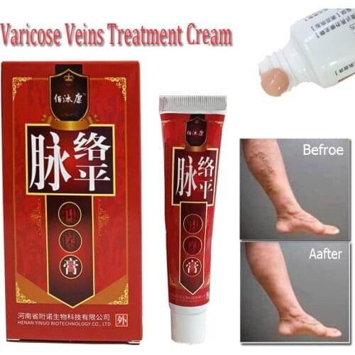 Varicose Veins Treatment Cream Ointment Vasculitis Phlebitis Angiitis Inflammation Blood vessel Rotten legs Varicose Veins Cream