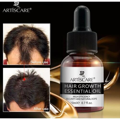 ARTISCARE Hair Growth Essential Oil Anti Hairs Loss Liquid Hair Repair Treatment Dense Hair Regrowth Serum Health Care Beauty