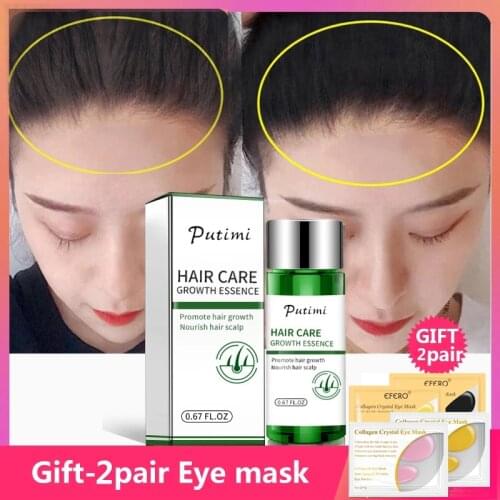 Putimi Natural Ginger Hair Growth Anti Loss Essence Effective Dense Hair Growth Essence Serum 20ml Prevent Baldness Hair Care