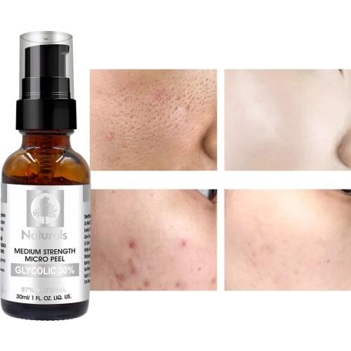 30% Glycolic Acid Pores Serum Improve Acne Scar Whitening Dark Spots Oil Control Brighten Skin Tone Anti-Aging Reduce Wrinkles