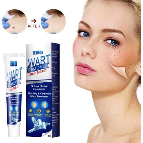 Skin Tag Remover Wart Remover Oitment Easy to Carry for All Skin Efficient Mole Removal Cream Herbal Extract Corn Plaster