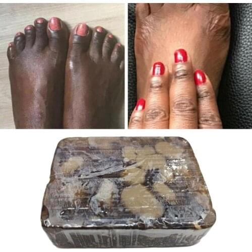 African Black Soap 100% Pure Unrefined Treatment Acne Acars Stretch Mark Soap Natural Magical Anti-taches Beauty Bath Body