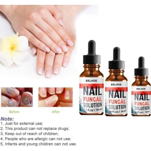 30ml Fungal Nail Treatment Pen To Remove Onychomycosis Anti Fungal Healthy Polish Nail Tool Care Liquid Paronychia Q1Q7