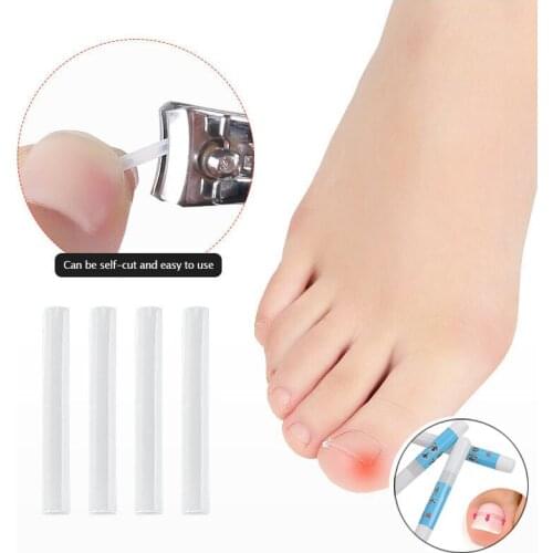 Ingrown Toenails Corrector Tools Pedicure Recover Embed Toe Nail Treatment professional Ingrown nail Correction Foot Care Tool