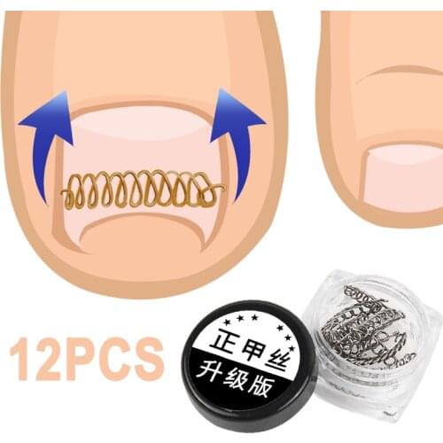 12pcs Nail Art Ingrown Toenails Correction Wire Recover Care Paronychia File Straightening Clip Corrector Foot Pedicure Tool