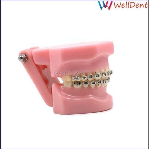 Dental Teeth Tooth Model Orthodontics Typodont Metal Brace bracket Typodont with Arch Wire Dentist Dental Lab
