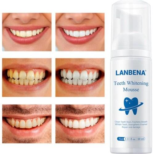 Daily Teeth Whitening Whiten Foam for Home Use Maintain a Brighter