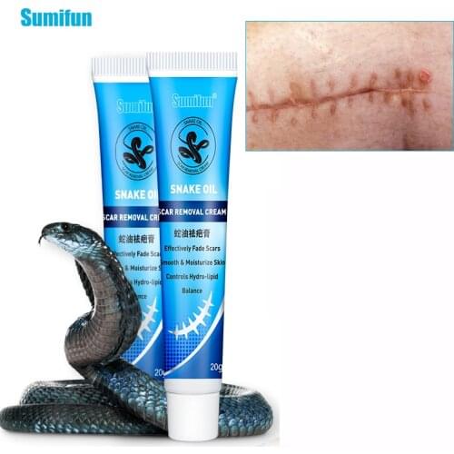 New Sumifun 1Pcs Repair Scar Cream Skin Repair Ointment Scar Stretch Marks Scar Removal Burns/Cuts Fade Stretch Marks Acne Cream