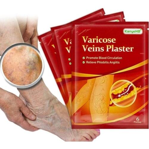 6 Pcs/bag Varicose Veins Plaster Ointmnet Vasculitis Phlebitis Spider Cream Varicosity Angiitis Removal Herbal Medical Plaster