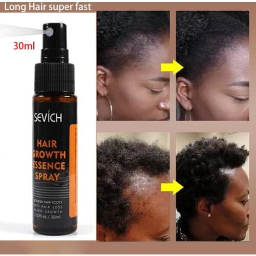 30ml Hair Growth Essence Spray Hair loss Treatment Preventing Hair Loss spray hair Growth Essence Hair Care