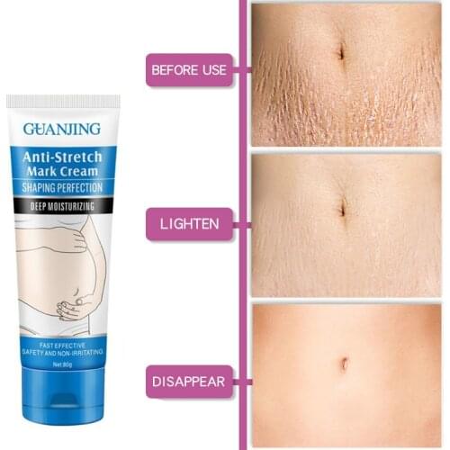 80G Remove Stretch Marks Cream Anti Wrinkle Anti Aging Maternity Skin Repair Remove Pregnancy Scars Treatment Body Skin Care