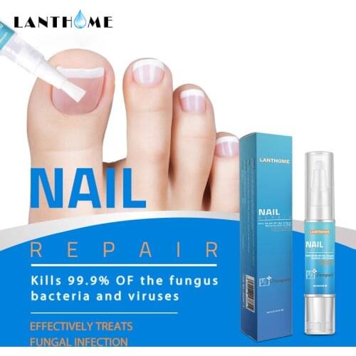 Powerful Nail Treatment Pen Onychomycosis Paronychia Anti Fungal Nail Infection Chinese Herbal Toe Fungus Care Repair Serum