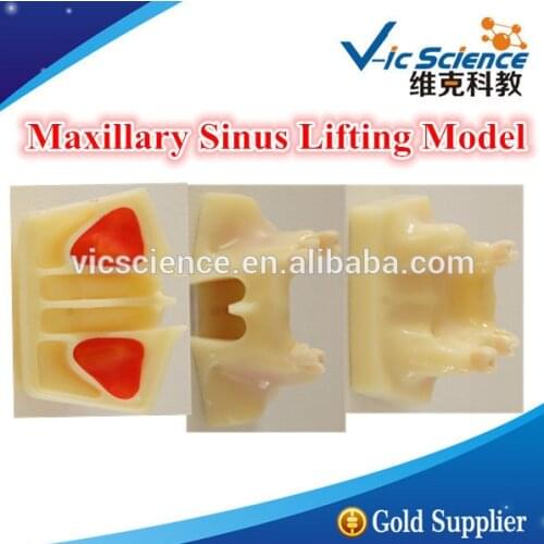 Maxillary Sinus Lifting Model/Sinus Lifting Model/Maxillary Sinus Lifting