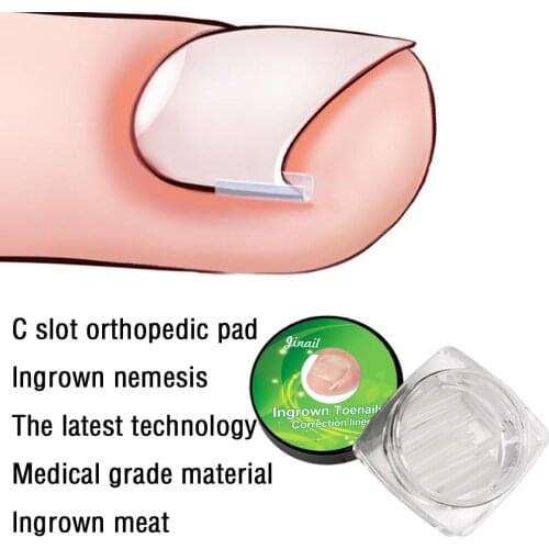 10pcs/set Ingrown Toenail Pad Ortho Nail Filling Nail Groove Pad Ingrown Nail Corrector Ingrown Nail Artifact Foot Care Tool