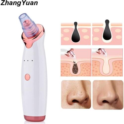 ZhangYuan New Facial Blackhead Remover Electric Pore Cleaner T Zone Acne Skin Care Tool Cleansing Spots Vacuum Suction Machine