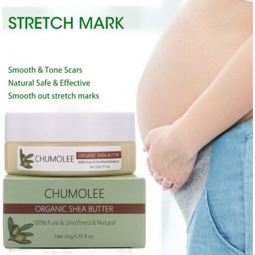 CHUMOLEE Natural Unrefined Shea Butter body Cream hand Body care Repair Maternity Stretch Marks skin Care Moisturizing Cream