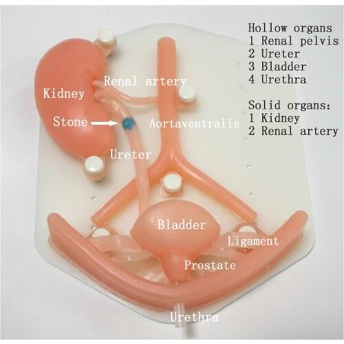 Silicone organ of urinary system,Laparoscopic training