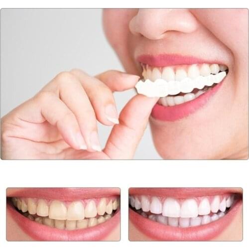 Upper & Lower Teeth Brace Whitening Cover Teeth Veneers Whitening Comfortable