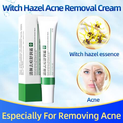 Clear Acne and Soothing Cream Oil Control Shrink Pores Treatment Face Pimple Scar Blackhead Remover Repair Ointment