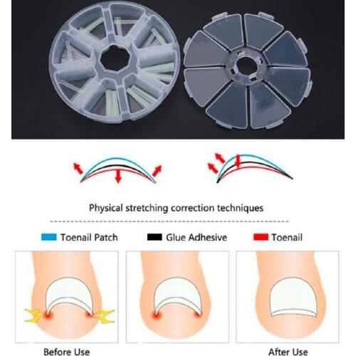 120pcs/box Ingrown Pedicure Toenail Straightening Clip Toe Nail Sticker Brace Toenials Thick Correction Patch Foot Care Tools