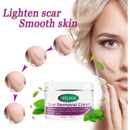30g/50g Body Scar Remove Cream Acne Surgical Burn Scars Treatment Stretch Marks Acne Spots Repairing Body Skin Care Tools