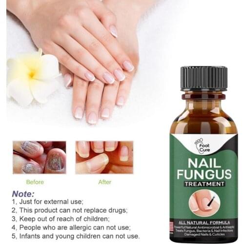 10ML Nail Fungus Treatment Fix Renew Damaged Broken Nail
