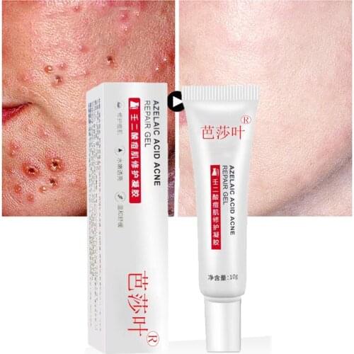7 Days Azelaic Acid Acne Removal Cream Fade Acne Spots Oil Control Anti-Acne Shrink Pores Acne Treatment Cream Face Gel Skin Car