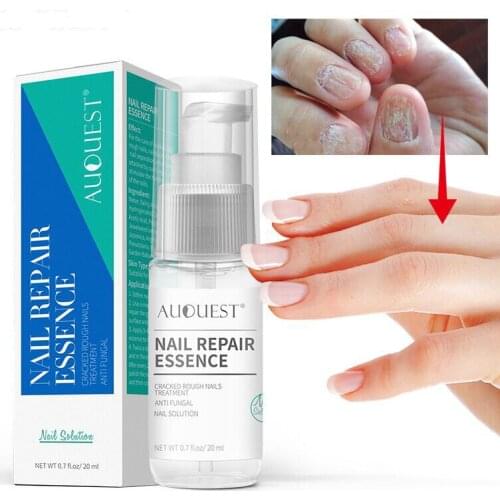 Масла для кутикулы APINKGIRL China At AliExpress