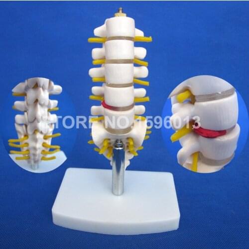Mini Lumbar Vertebra Model with Sacrum,Coccyx and Herniated Disc, Waist spine and Caudal Vertebra Model