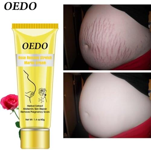 OEDO Scar Removal Cream Rose Remove Stretch Mark Cream Nourish Pregnant Women Skin Repair Remove Obesity Tattoo Body Care