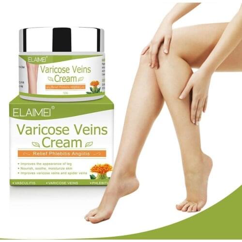 50ml Varicose Vein Ointment Remove Red Blood Streaks Varicosity Veins Angiitis Medical Plaster Vasculitis Phlebitis Spider Cream
