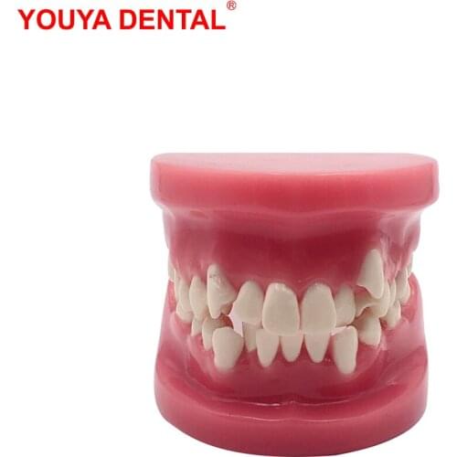 3D Resin Dental Model Teeth Malocclusion Model For Demostration Teaching Dentist Students Study Oral Medical Dentistry Products