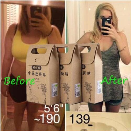 100pcs Chinese Medicine Slimming Diets Patch Weight Loss Strongest Slim Patch Pads Detox Adhesive Sheet Face Lift Tool