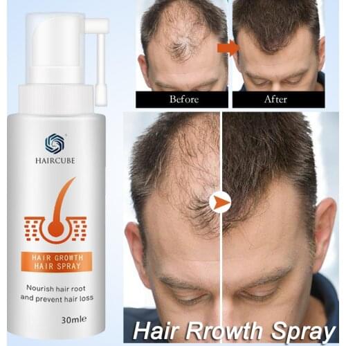 HAIRCUBE Hair Growth Products Hair Growth Serum Spray Hair Care Hair Treatment Oil Organic Anti Hair Loss Fast Hair Growth Spray