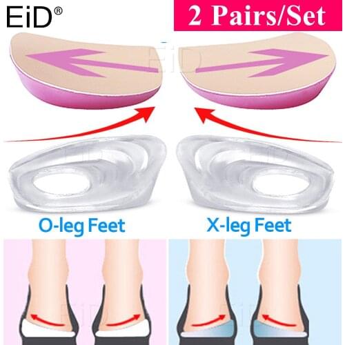 Silicone Gel XO Legs Orthotic Insoles Silicone Gel Arch Support Pad for Women Flat Foot Orthopedic Inserts Pain Relief Shoe pad