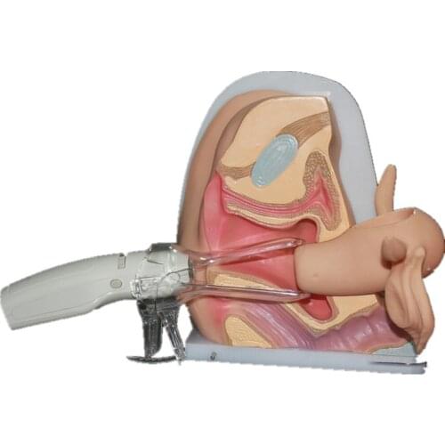 Female Reproductive Vagina Model Gynecological model props Vaginal ovarian model