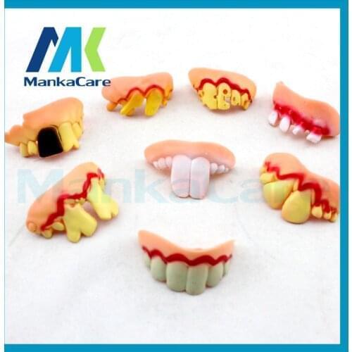 Dental toy Tooth Halloween braces Teeth socket dentist Funny Practical Jokes Prank Horror Fun Shocker Novelty Funny Denture
