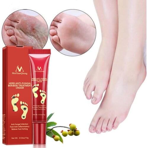 Herbal Effective Foot Cream Treatment Anti Fungal Infection Onychomycosis Paronychia Toe Fungus Gel Repair Dry Crack SPA Detox