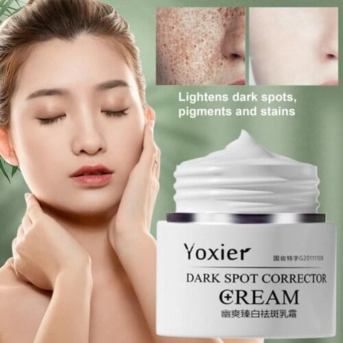 Yoxier Dark Spot Removal Cream Freckle Cream Dark Spots Corrector Fade Pregnancy Spot Acne Melanin Pigmentation Whiten Skin Care
