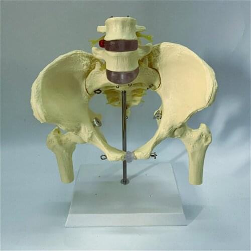 1:1 Human pelvic bone model skeleton femur sacrum lumbar vertebra Teaching medical explanation disc slipped