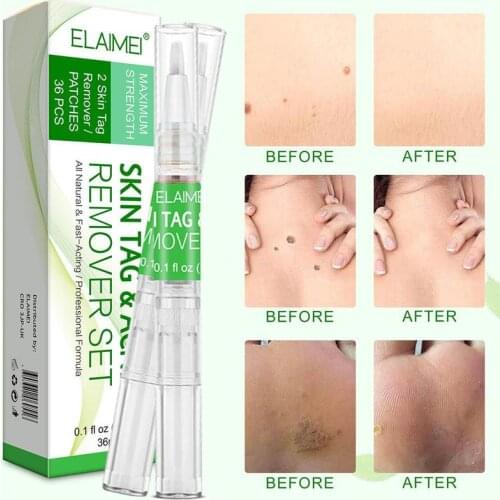 2pcs to remove wart pen corn meat thorn wart stick faded mole spots reduction 36 plaster body wart mark skin fragment mark I4N4