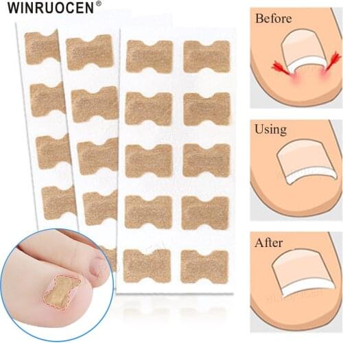10pcs/set Professional Ingrown Toenail Correction Tool Embedded Toe Nail Corrector Elastic Patch Sticker Pedicure Tool