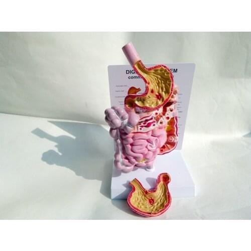 1/2 Life Size Human Digestive System Anatomical Model Colorectal Duodenal Viscera Stomach Structure Model