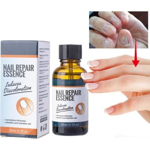 30ml Nail Repair Essence Nourishing Protect Fingernail Toenail Anti Infection Paronychia Onychomycosis Nail Fungus Removal Gel
