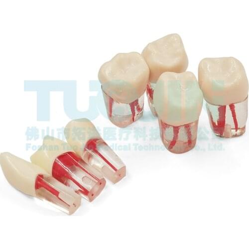 5PCS Dental Tooth Model Root Canal RCT Practice Pulp Cavity Clear Resin Teaching Teeth Model For Student Study Lab Equipmenent