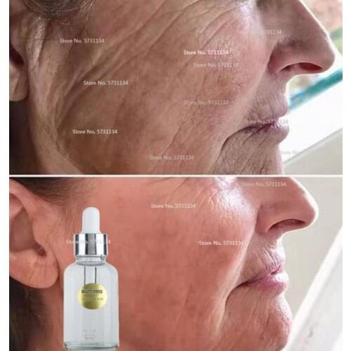 BRADYEXPRESS Serums With Vitamin C For The Face