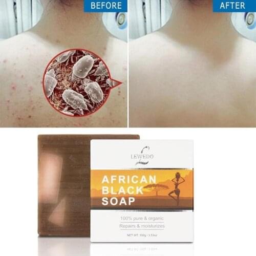 African Black Soap Magic Anti Rebelles Beauty Moisturizing Natural Bath Body Treatment Acne Skin Care Skin Repair 100g