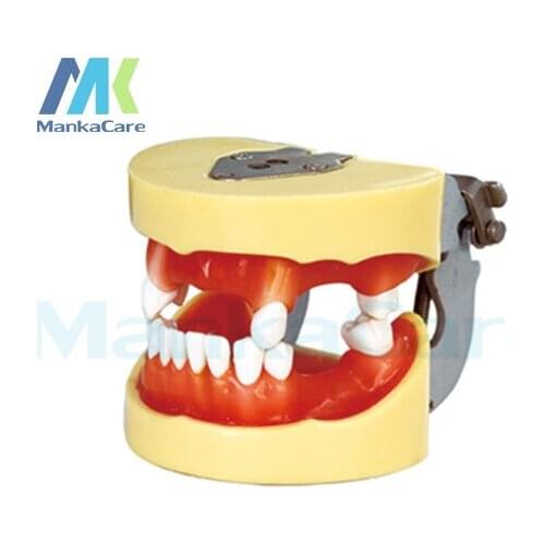 Manka Care - Implant Model Oral Model Teeth Tooth Model