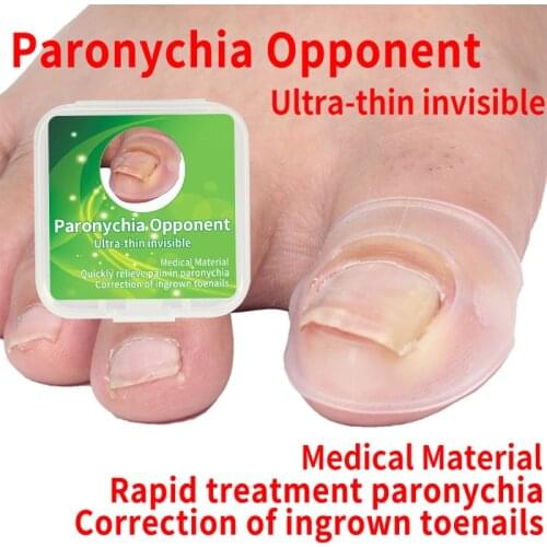 Ingrown Armor Elastic Patch Sticker Straightening Clip Brace Toenail Correction Tool Ingrown Toe Nail Treatment Pedicure Tool